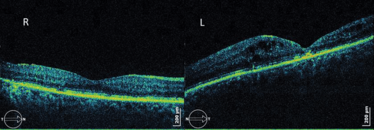 0614-605-fig.4 0614-605-fig.4