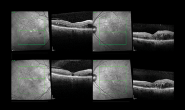 0614-601-fig.2 0614-601-fig.2
