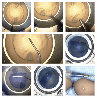 0114-401-fig1 0114-401-fig1