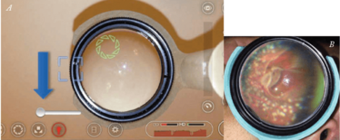 0414-201-FIG.2 0414-201-FIG.2