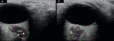 0814-401-fig.2 0814-401-fig.2