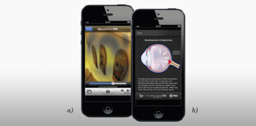 Figure 1. The Glaucoma SIM app Figure 1. The Glaucoma SIM app