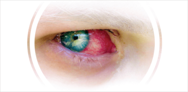 Main Teaser of an Eye for Article Bak Off Main Teaser of an Eye for Article Bak Off