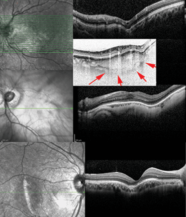 0213-401_Fig3x345 0213-401_Fig3x345