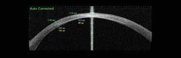 0514-403-fig.2 0514-403-fig.2
