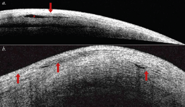 1114-401-fig1 1114-401-fig1