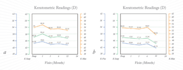 Figure 3. Corneal curvatures after corneal cross-linking (A) and accelerated corneal cross-linking (B) Figure 3. Corneal curvatures after corneal cross-linking (A) and accelerated corneal cross-linking (B)