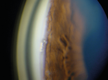 0115-401-fig1