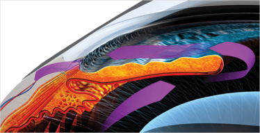 An illustration of fluid flowing through the trabecular meshwork An illustration of fluid flowing through the trabecular meshwork