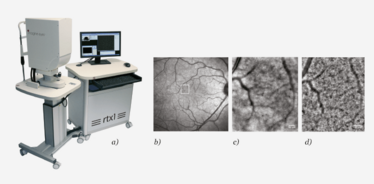 Figure 3. (a) Imagine Eyes (b) shows a wide field fundus image from the right eye The white box indicates the area of the retina shown in panels (c) and (d) Figure 3. (a) Imagine Eyes (b) shows a wide field fundus image from the right eye The white box indicates the area of the retina shown in panels (c) and (d)